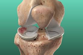 Anatomía de los meniscos