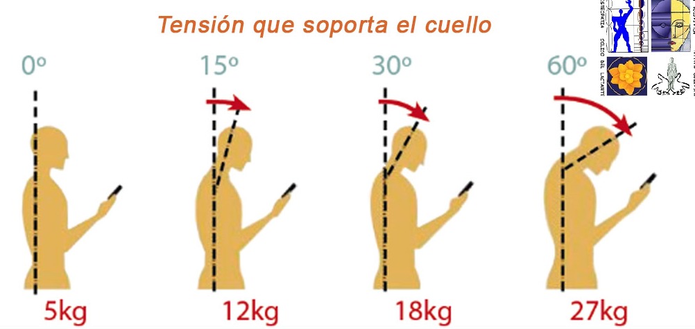 Dolor cervical por uso prolongado del móvil
